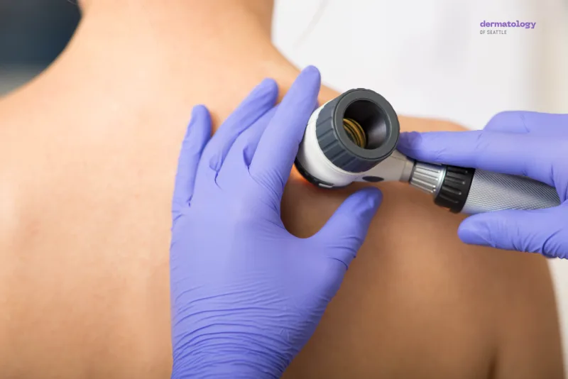 Dermatologist performing skin treatment
